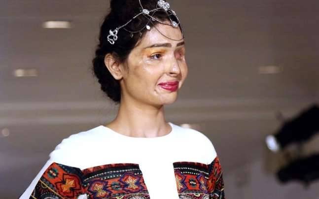 Reshma la modella sfigurata dallacido sfila a New York