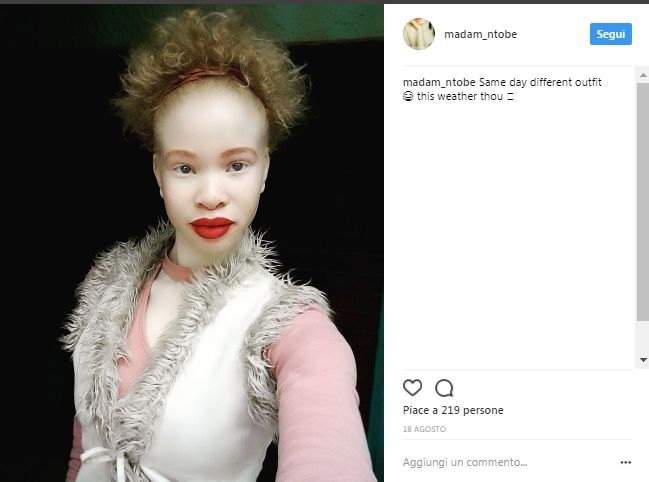 Nontobeko la modella africana orgogliosa della sua pelle bianca