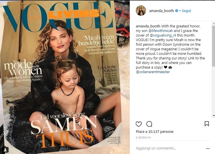 La svolta di Vogue Olanda la modella posa con il figlioletto affetto dalla sindrome di Down