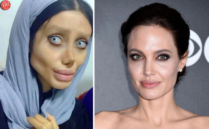 50 interventi per somigliare ad Angelina Jolie ma è un fake