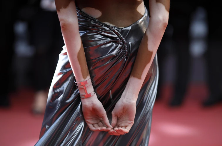 Winnie Harlow la top model con la vitiligine incanta a Cannes