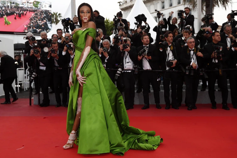 Winnie Harlow la modella con la vitiligine incanta a Cannes