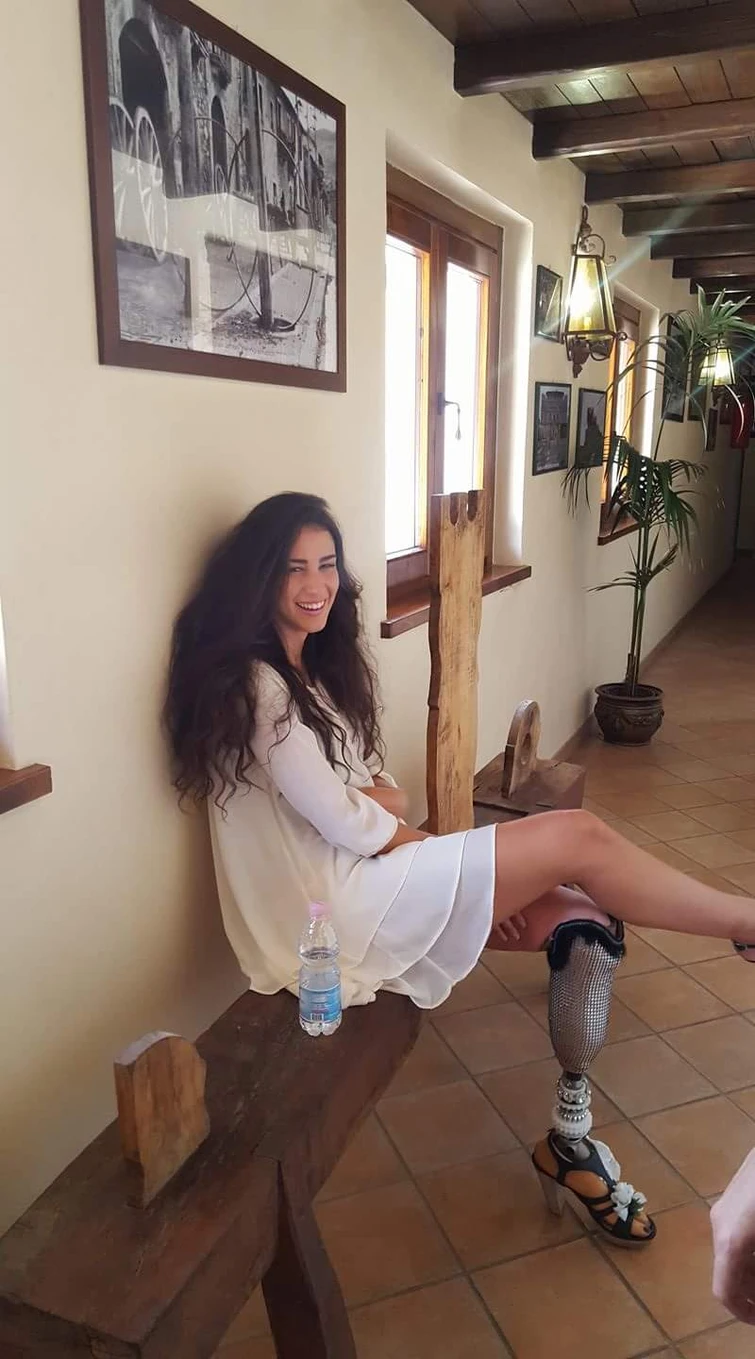 Chiara a Miss Italia con la protesi alla gamba