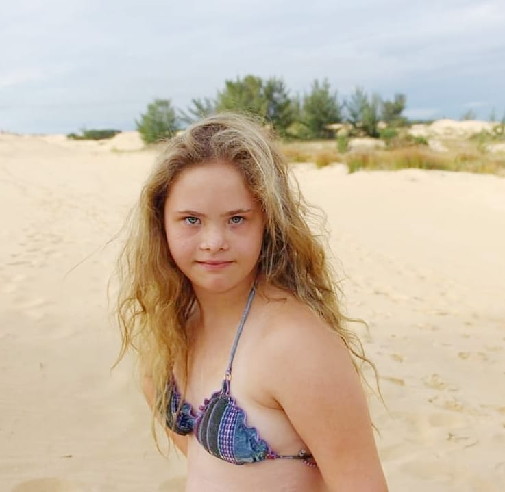 Georgia la modella 14enne con sindrome di Down star dei social