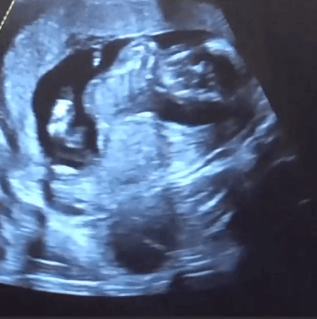 Emily Ratajkowski è incinta la risposta fulminante sul sesso del bebé