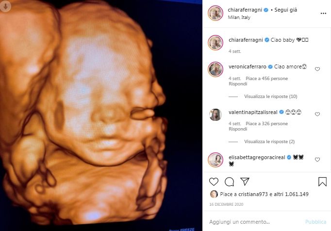 Dallannuncio alla recente caduta la gravidanza di Chiara Ferragni è la più condivisa e il totonome impazza