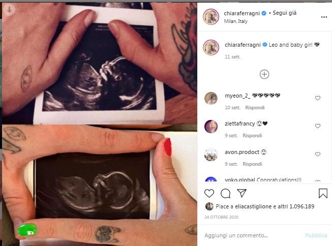 Dallannuncio alla recente caduta la gravidanza di Chiara Ferragni è la più condivisa e il totonome impazza