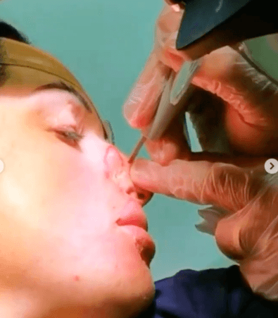 Dopo il calvario durato 4 anni Gessica Notaro  mostra per la prima volta gli effetti devastanti dellacido sul suo viso