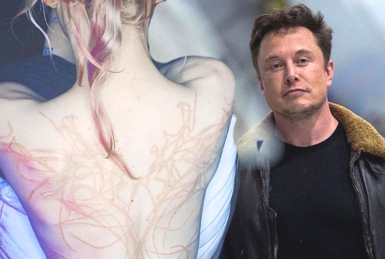 La compagna di Elon Musk mostra le cicatrici aliene sulla schiena