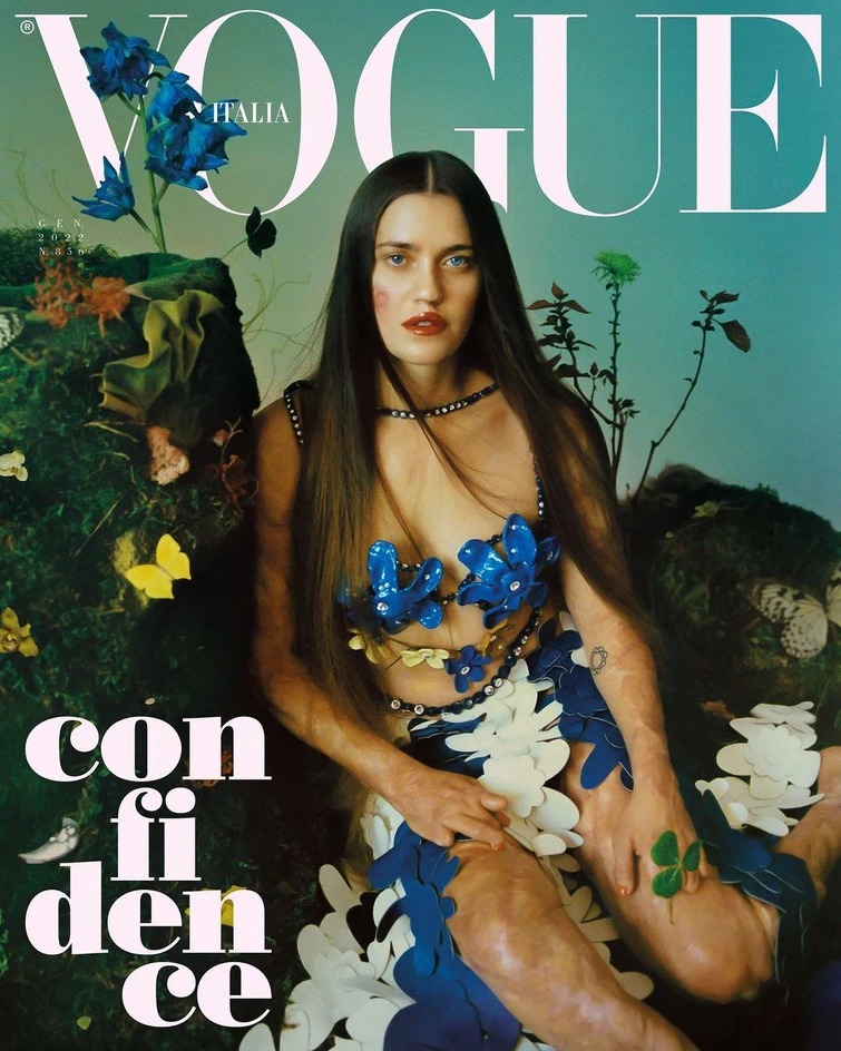 Non solo Bebe Vio il coraggio di Veronica latleta colpita da meningite batterica sulla copertina di Vogue