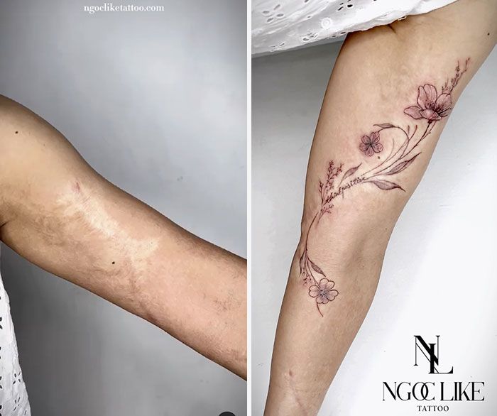 I tattoo più belli per cancellare le cicatrici lasciate dagli interventi chirurgici più duri le immagini che toccano il cuore