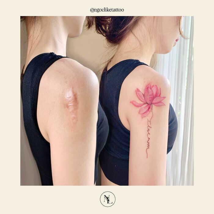 I tattoo più belli per cancellare le cicatrici lasciate dagli interventi chirurgici più duri le immagini che toccano il cuore