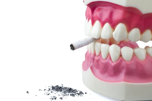 Tumore del cavo orale prevenirlo si può mentre una diagnosi tempestiva salva la vita