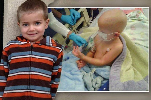 Burioni Il bimbo di 7 anni è morto per il morbillo non per la leucemia