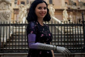 Federica ha la sua mano bionica un sogno che si avvera Il suo pitbull le aveva strappato il braccio