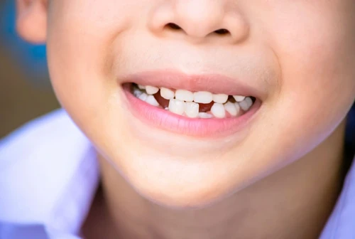 Un sorriso a 32 denti anche da anziani scoperto un farmaco che fa ricrescere i denti