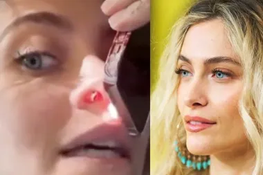 Paris Jackson naso bucato