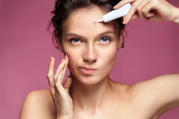 Acne: SOS pelle per la Generazione Z